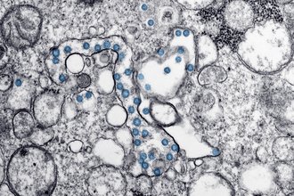 Microscope image of an isolate from the first U.S. case of COVID-19