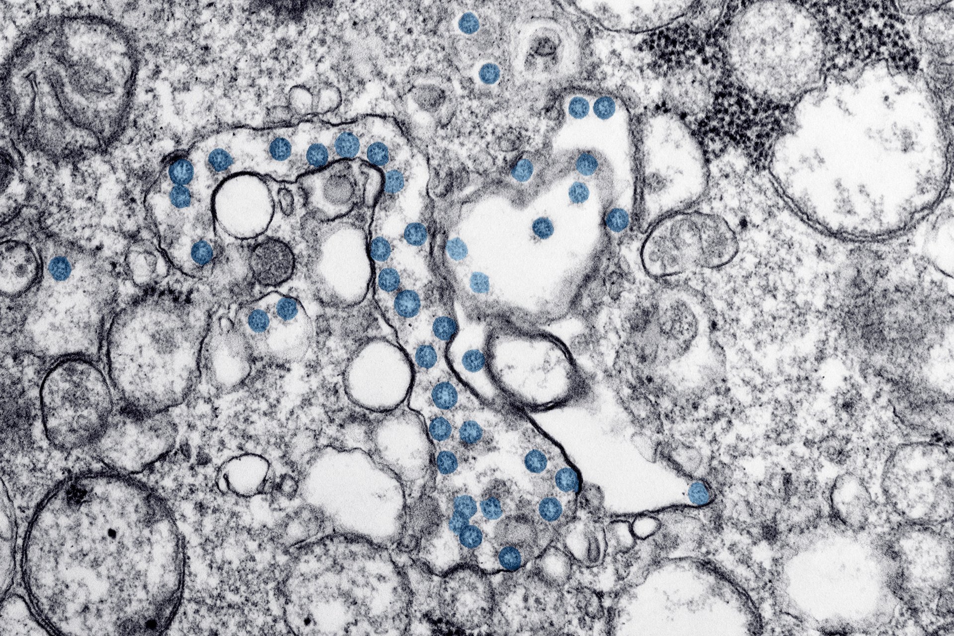 Microscope image of an isolate from the first U.S. case of COVID-19