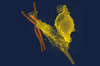 Magnified photo of neutrophil engulfing anthrax bacteria
