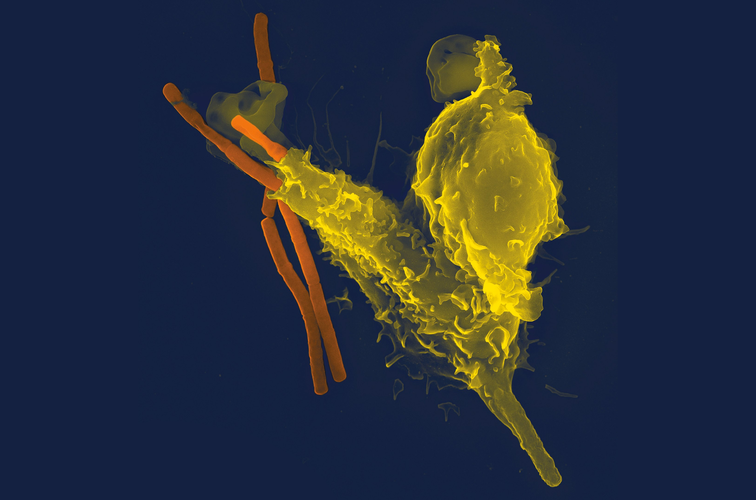 Anthrax versus antigen